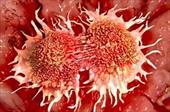 سلول های بنیادی ودرمان سرطان